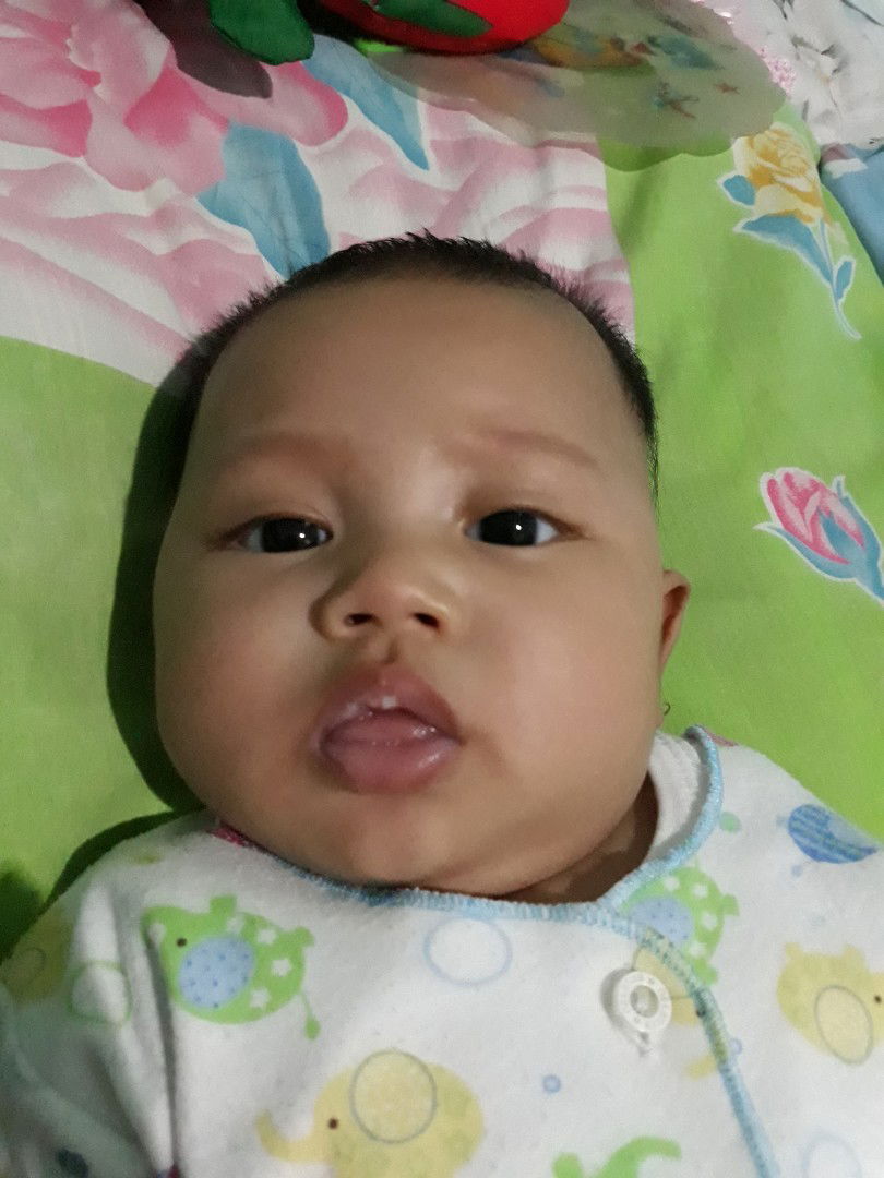 bibir bayi 2bulan kering ngelupas.