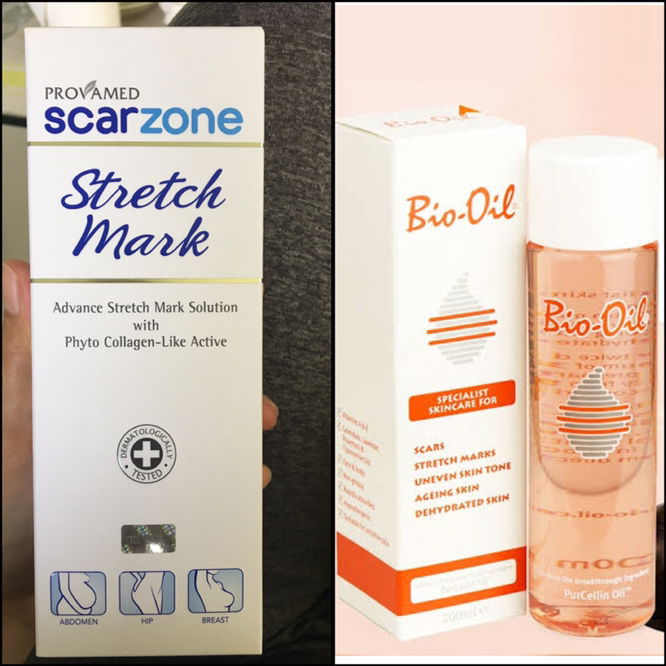 ครีมทาท้องแตก