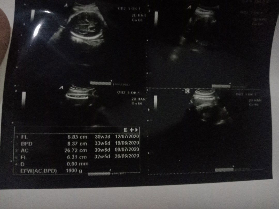 cara biar janin besar