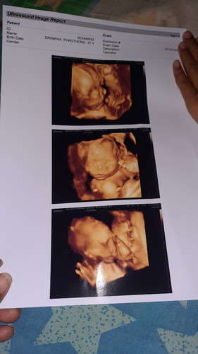 คุณหมอบอกดิ้นเก่งมากๆ