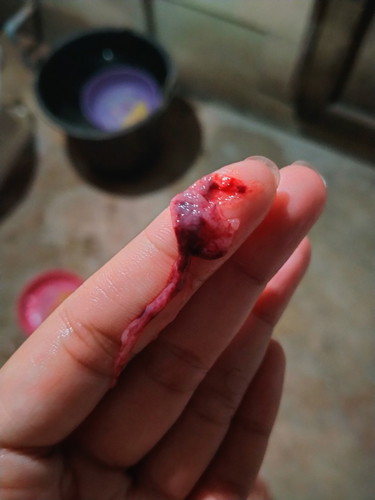 แบบนี้แท้งไหมค่ะ