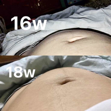 แบบนี้คือน้องยืดตัวหรืออะไรคะ