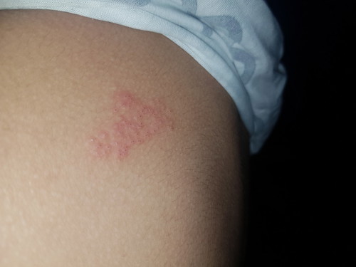 skin problem