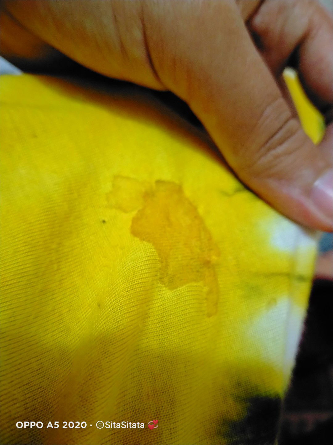 di payudarah keluar cairan kuning