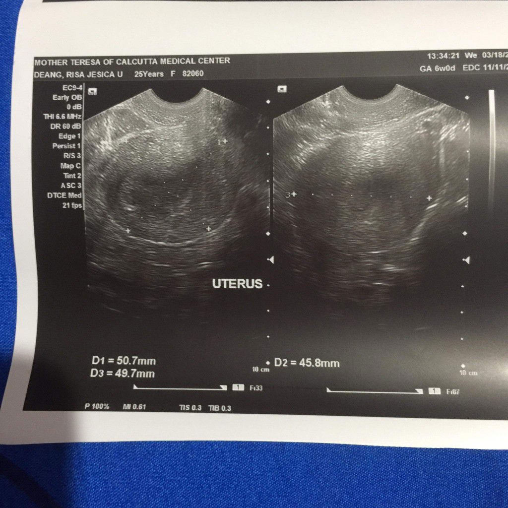 6weeks pregnant today