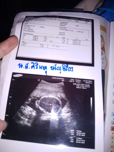 25wks