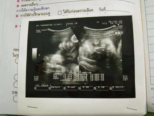 ตั้งครรภ์