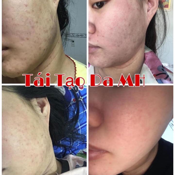 các vấn đề về da sau sinh