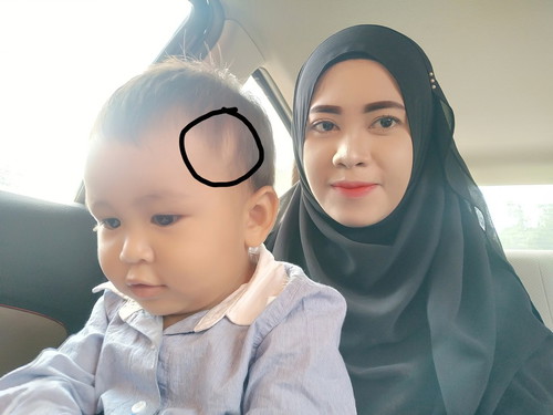 ผมเสียดสีไม่ขึ้น