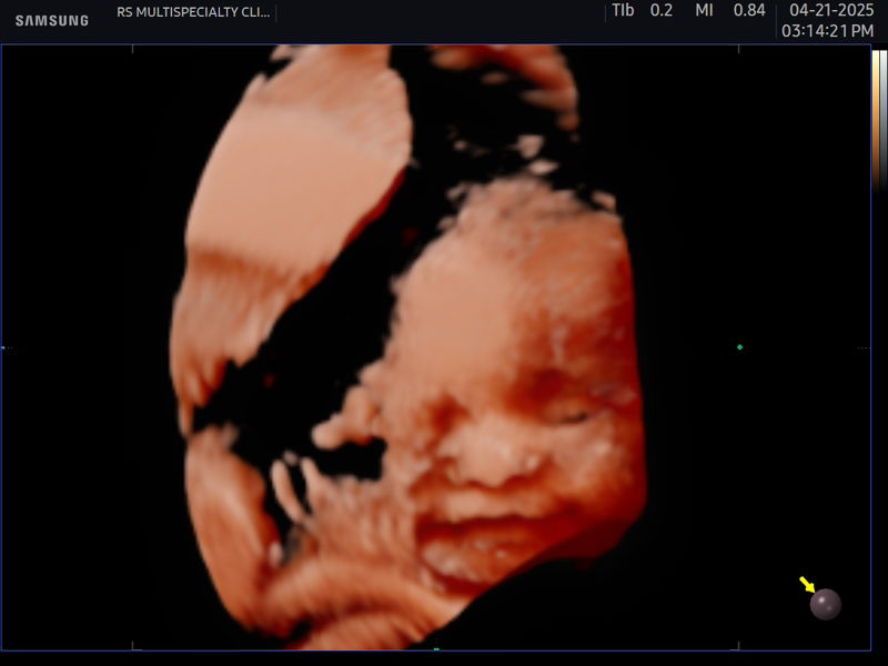 Maria Zyra Ysabel Izon profile icon