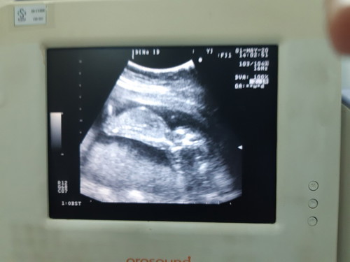 แม่ท่านใดท้อง15weekบ้างคะ