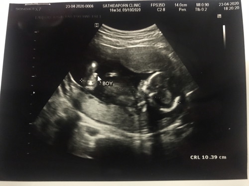 ผู้ชายชัวไหม?