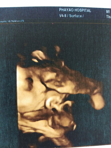 อยากให้ลูกตัวโตๆค่ะ