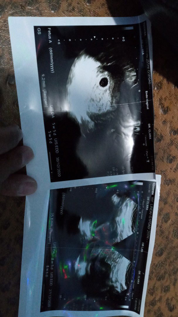 janin tudak berkembang