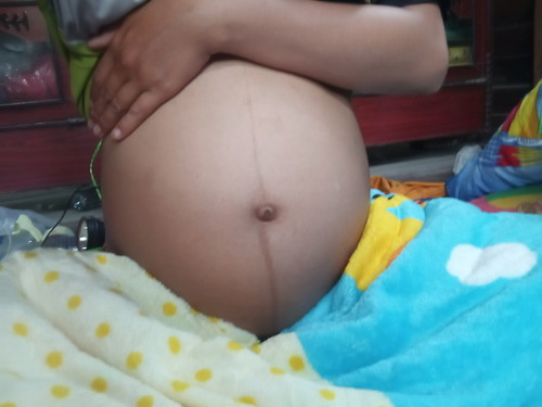 29 วีค ยังไม่รู้เพศ