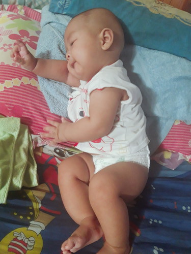 ลูก4เดือน26วัน มีเสมหะครืดคราดใคคอ