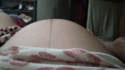 Pwde na po ba manganak ang 34weeks ??