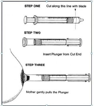 DIY nipple puller | Alat untuk membantu ibu menyusukan baby dengan puting tenggelam