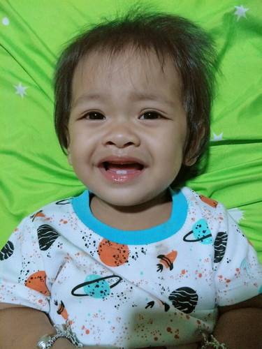 น้องๆที่อายุ1ขวบฟันขึ้นกันกี่ซี่บ้างแล้วค่ะ