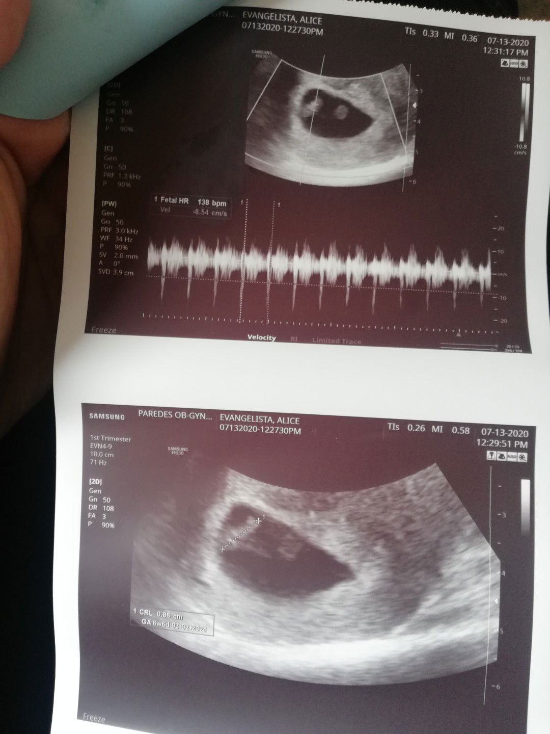 Anyone Who Also Experienced This?