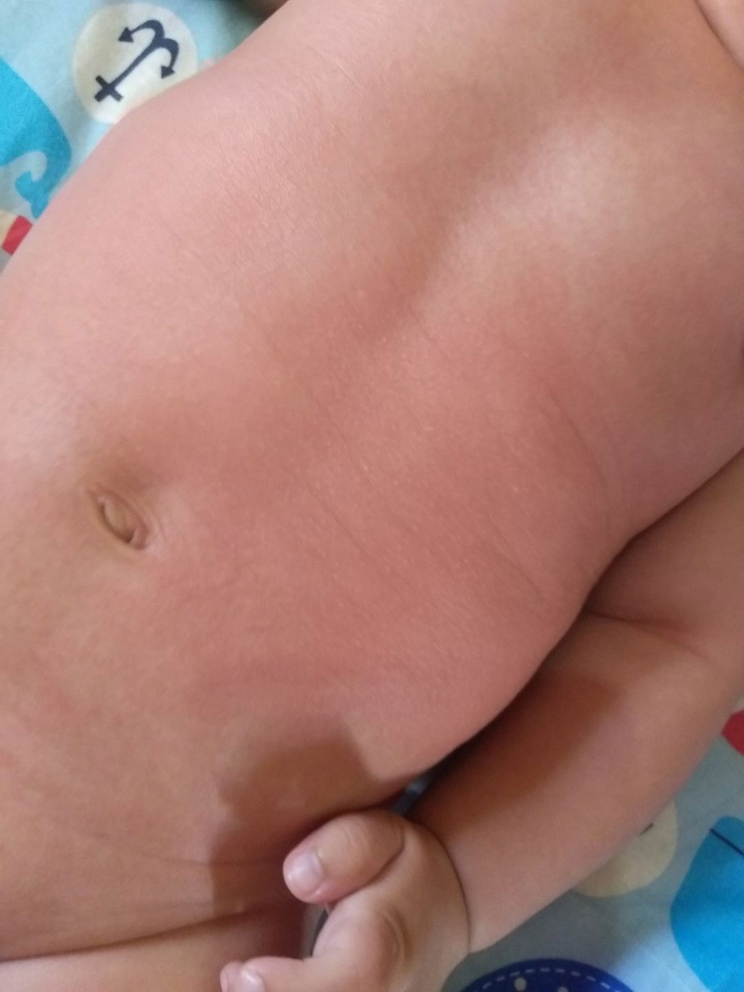 Tidak cocok dgn minyak telon merk tertentu