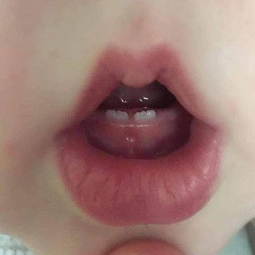 melahirkan RS / BIDAN menggunakan bpjs