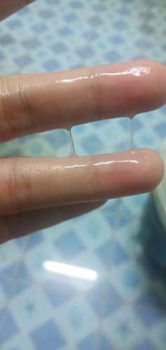 มีมูกใสๆแบบนี้จะเป็นไรมั้ยคะ