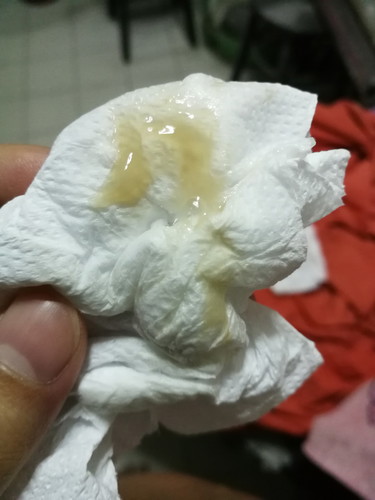 มูกสีไหนถึงไปหาหมอ