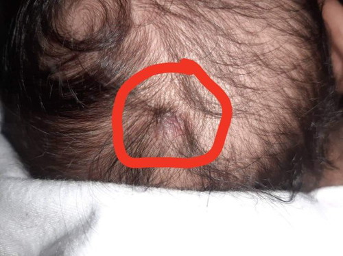 Skin problem