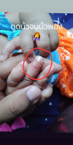 ทำยังไงดีคะ?