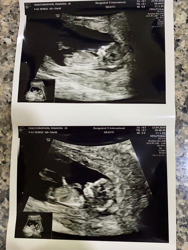 A'Jaeng profile icon