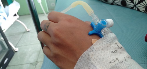 air ketuban sedikit