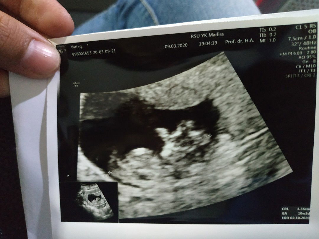 Yati Oktarina profile icon