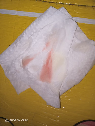 bleeding