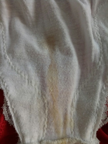 white discharge