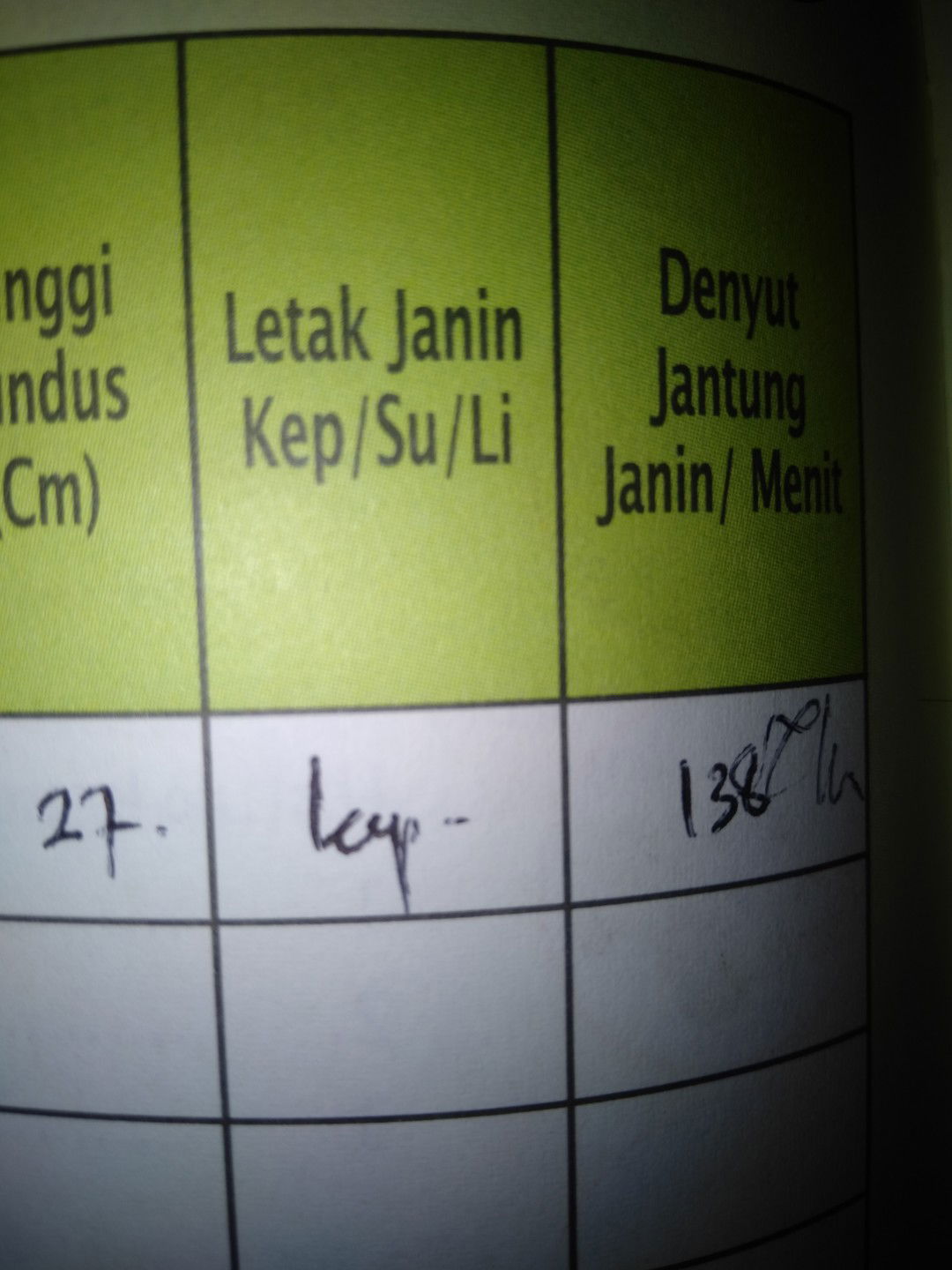 letak janin