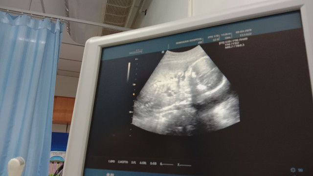 อัลตร้าซาว