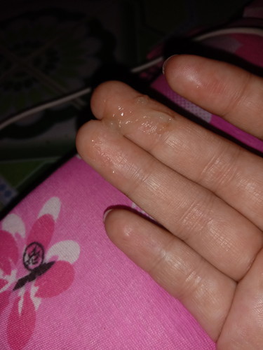 ตกขาว
