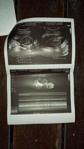 gender?