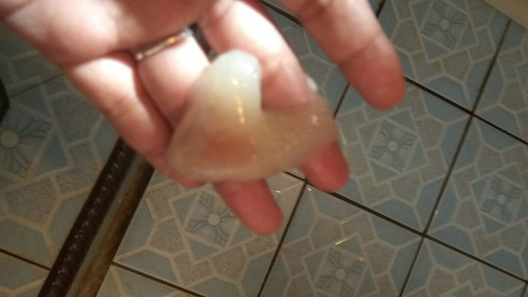 keluar gumpalan lendir