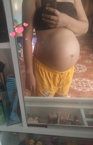 แฝดจร้า ท้องเล็กหรือเปล่าค่ะ.