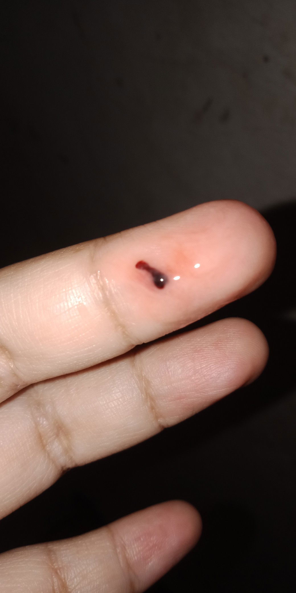 Keluar Darah Flek dan keputihan