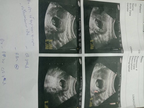 ขอโทษทีทำให้หนูเกิดมาไม่ได้