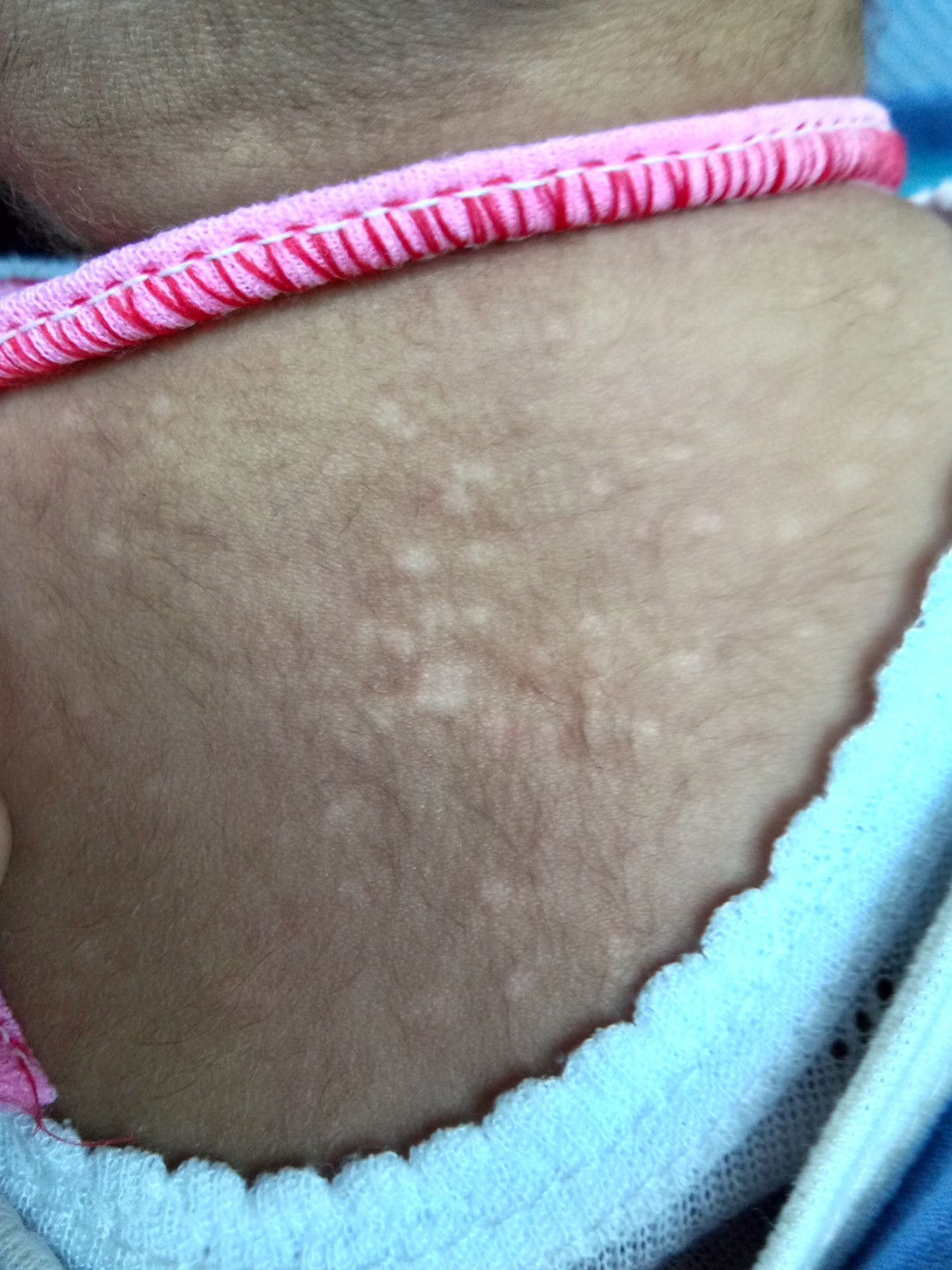 bintik putih pada baby