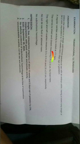 Questions on my mind