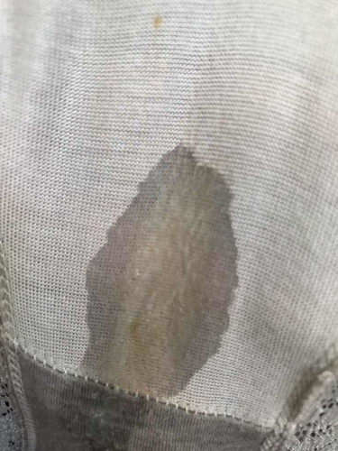 Paminsanang discharge at 33 weeks