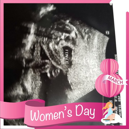 นางฟ้าน้อย