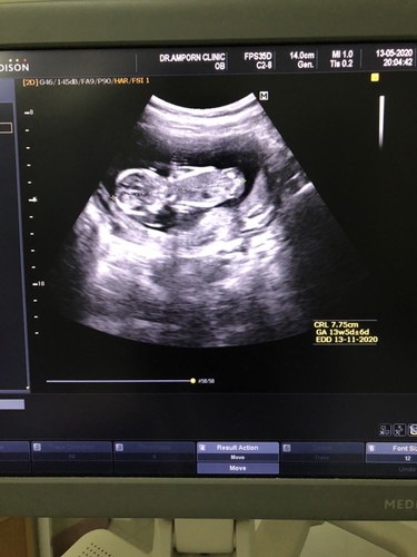 ตัวเล็กของแม่??