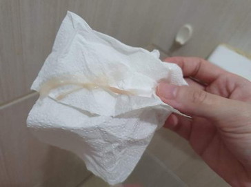 Vaginal discharge with blood tinged 20 weeks