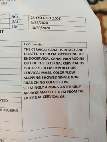 cervical polyp